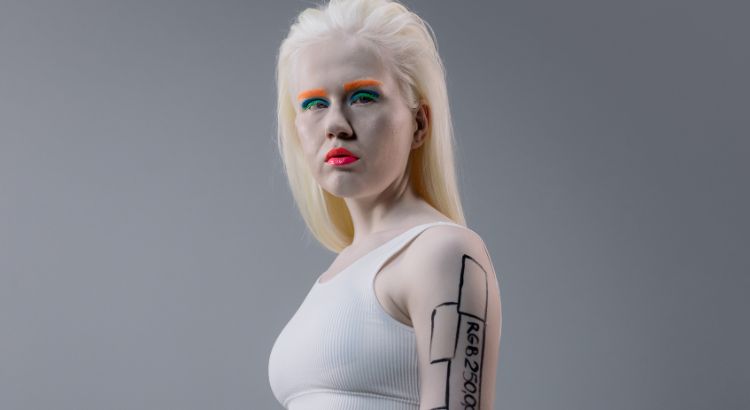 modelle albine