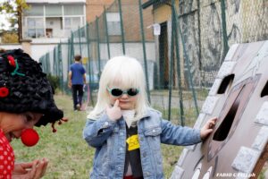 bambina albina con occhiali scuri