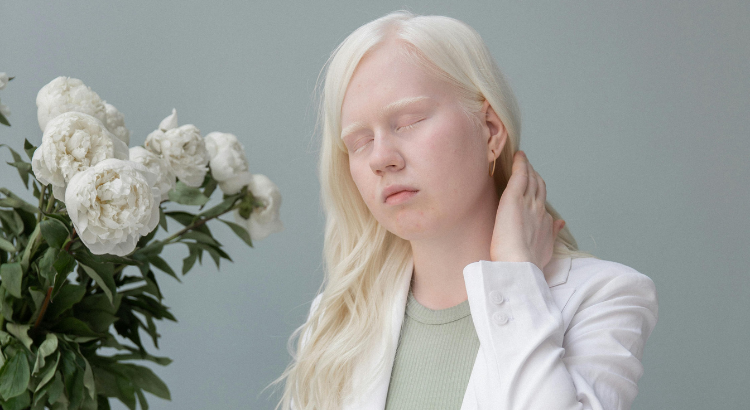 ragazza albina con cervicalgia